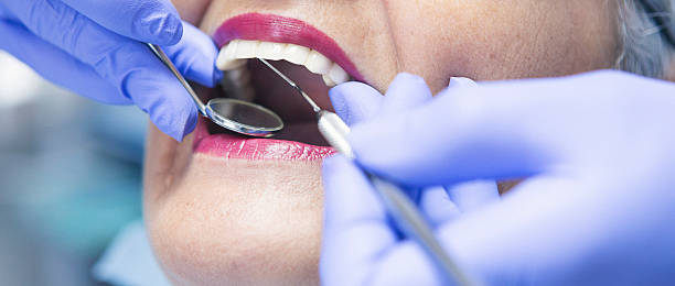 Best Emergency Dental Care for Broken or Chipped Teeth in Dunn Loring, VA